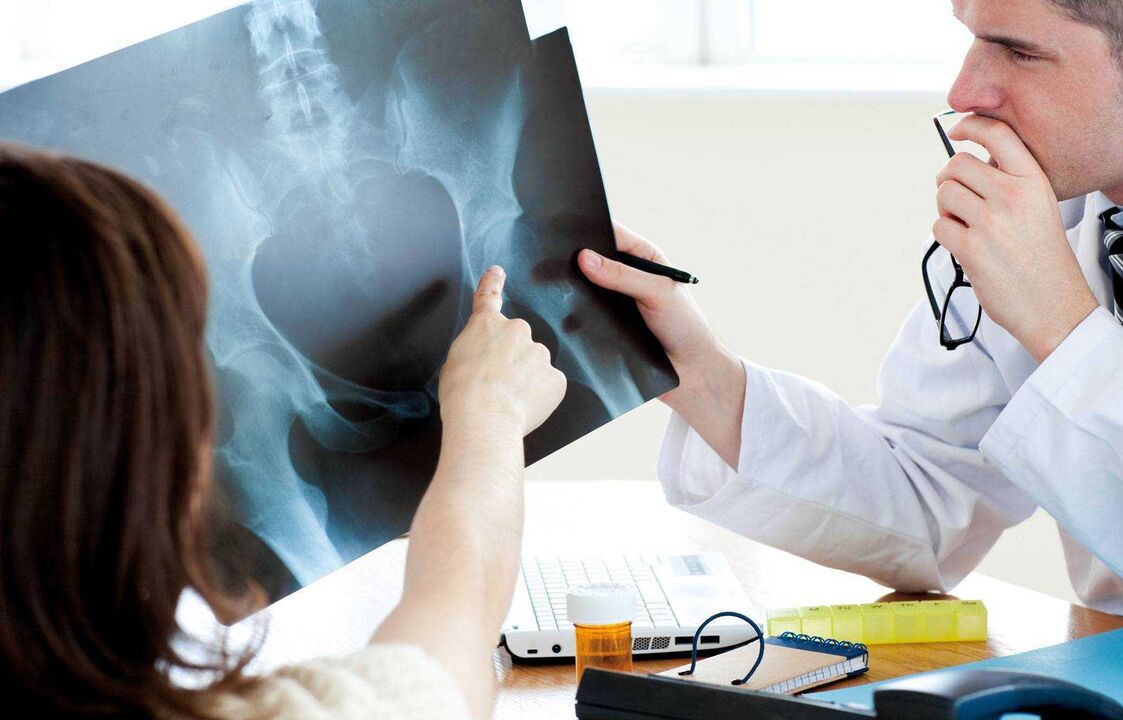 doctor checking x-ray for hip disease