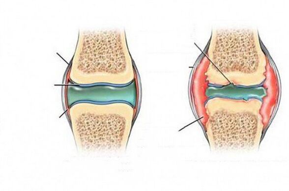 The deformation process of joints