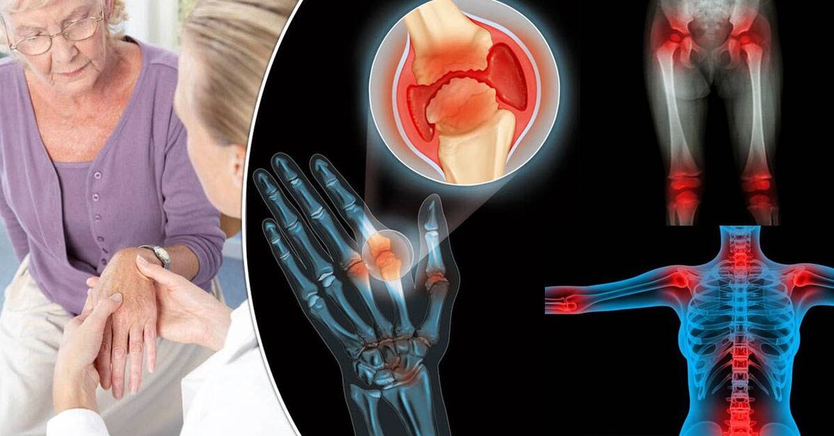 What is joint disease